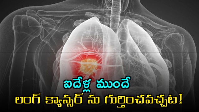 Lung cancer can be detected five years early with a drop of blood