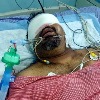 Kathi Mahesh eye injured in accident