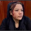 Taliban beaten a woman activist in Kabul