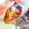 Taking flu shot may cut heart disease risk: Study