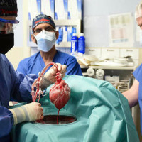 US doctors transplant full live pig heart into human patient 