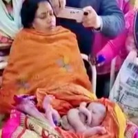 woman gives birth to baby with four hands and legs in bihar