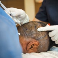 Police Constable died after hair transplantation