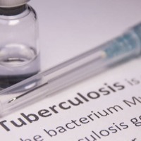 TB curable if right drugs taken for right duration: TB Institute chief