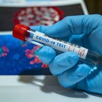 Eight people tested covid positive in AP