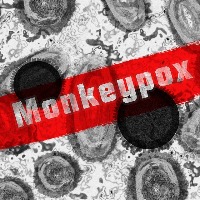 Quote on monkeypox by Rakesh Jain