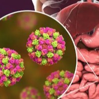 Kerala confirms 2 cases of Norovirus