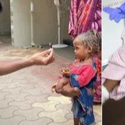 Sonu Sood helps little Bihar girl who was born with four legs four arms