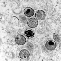 Delhi Man Tests Positive For Monkeypox