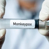 Center calls for high level meeting on Monkeypox spreading