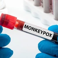 Monkeypox outbreak can be stopped says WHO official