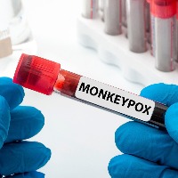 Indias first monkeypox death in kerala