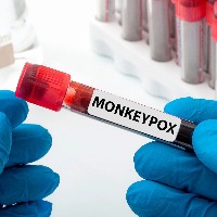 Suggest new name for MonkeyPox asked WHO