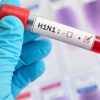 Swine flu strikes again after 3 years in Hyderabad