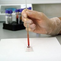 Scientists develops new blood test that can detect multiple cancers 