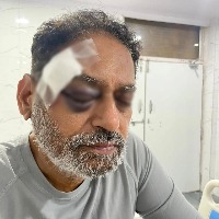 Pushed by cops, Maha Congress' Dr. Nitin Raut hurt in Bharat Jodo Yatra