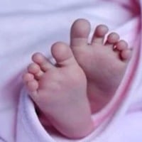 Infant born with rare deformity in Bihars