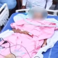 Warangal PG doctor Preethi Health Condition is Serious and Treatment Continue in NIMS