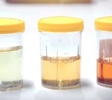 Heres what your urine colour is telling you about your health