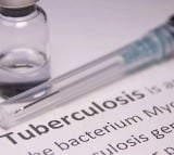 TB treatment time to be reduced
