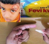 Private hospital staff treat kids injury with fewikwik instead of closing it with sutures in Jogulamaba gadwal district