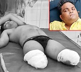 Khamman youth loses both legs while trying get on a moving train in Rajamahendravaram station
