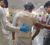 AIIMS Delhi performs successful surgery by removing knife from man's back