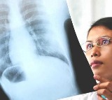 your X rays can help you diagnose diabetes early