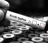 Scrub Typhus Virus Reported In Maharashtra