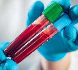 New blood test may detect ovarian cancer early with 91% accuracy