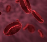 UK approves world’s 1st gene therapy to treat sickle-cell, thalassemia