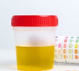What makes urine yellow researchers finally find out the cause