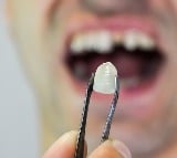 New technique to replace lost teeth: Experts