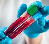 New blood test can spot Alzheimer's risk 15 yrs before symptoms appear