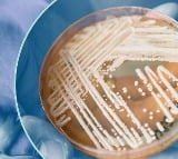 Deadly Fungal Infection Candida Auris Rapidly Spreading In USA