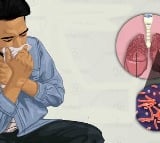 TB diagnosis must go beyond persistent cough: Lancet study