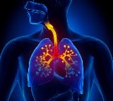 COPD, asthma to drive India’s critical care ventilator market: Report