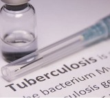 Many cases of TB can appear without symptoms like cough: Experts