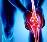 Early detection of 'osteoarthritis' may allow therapy that improves joint health: Researchers