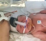 Study shows how to boost lung health of premature babies