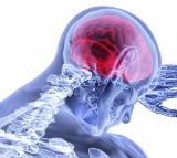 Dementia caused by fluid accumulation in brain treatable