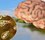 Nilofar doctors warns that be caution with brain eating amoeba