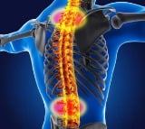 Study shows spinal muscular atrophy may raise risk of liver damage