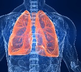 Why are most lung cancer patients in India non-smokers?