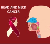 Head and neck cancers on the rise in India, youth at key risk: Experts