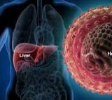 What is viral hepatitis and how is it affecting people?