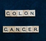 Doctors flag concerns on rising colon cancer cases among adults under 50