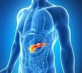 Pancreatic cancer patients may benefit from a ketogenic diet