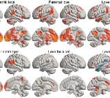 Scientists reveals how love lights up different parts of human brain