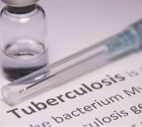 Study explains why treatments for autoimmune, inflammatory diseases raise TB risk